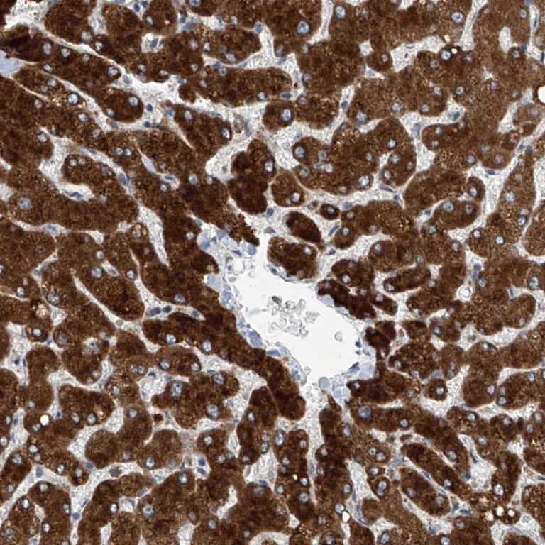 Immunohistochemistry (Formalin/PFA-fixed paraffin-embedded sections) - Anti-EIF2D antibody (AB251784)