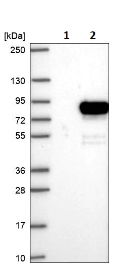 Western blot - Anti-EIF2D antibody (AB251784)