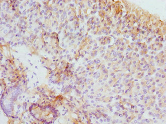 Immunohistochemistry (Formalin/PFA-fixed paraffin-embedded sections) - Anti-EIF2G/EIF2S3 antibody (AB225953)