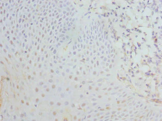 Immunohistochemistry (Formalin/PFA-fixed paraffin-embedded sections) - Anti-EIF2G/EIF2S3 antibody (AB225953)