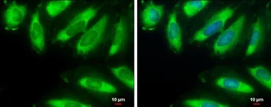 Immunocytochemistry/ Immunofluorescence - Anti-EIF2S1 antibody (AB137626)