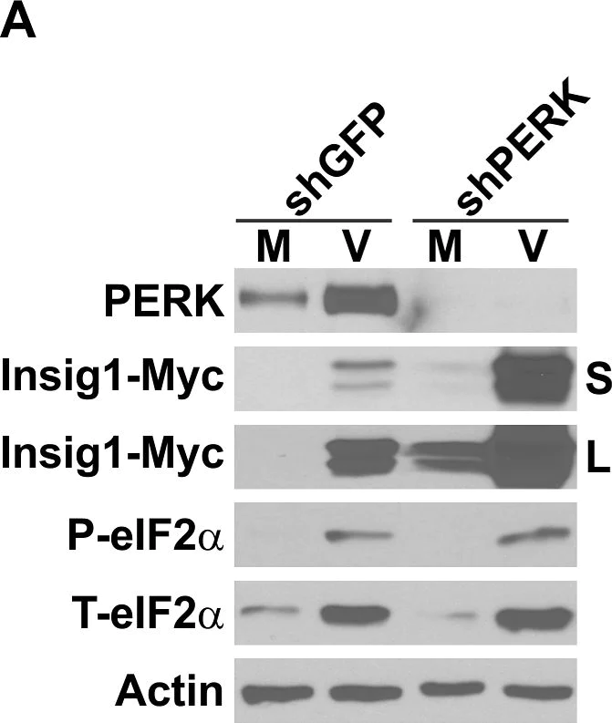 Western blot - Anti-EIF2S1 antibody [EIF2S1A2B8] (AB50733)