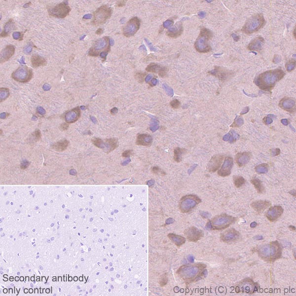 Immunohistochemistry (Formalin/PFA-fixed paraffin-embedded sections) - Anti-EIF2S1 antibody [EPR23098-50] (AB242148), expandable thumbnail