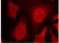 Immunocytochemistry/ Immunofluorescence - Anti-EIF2S1 (phospho S49) antibody (AB131489)