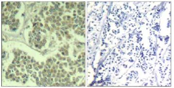 Immunohistochemistry (Formalin/PFA-fixed paraffin-embedded sections) - Anti-EIF2S1 (phospho S49) antibody (AB131489)