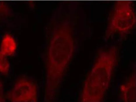 Immunocytochemistry/ Immunofluorescence - Anti-EIF2S1 (phospho S51) antibody (AB131505)