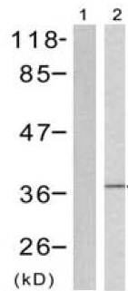 Western blot - Anti-EIF2S1 (phospho S51) antibody (AB131505), expandable thumbnail