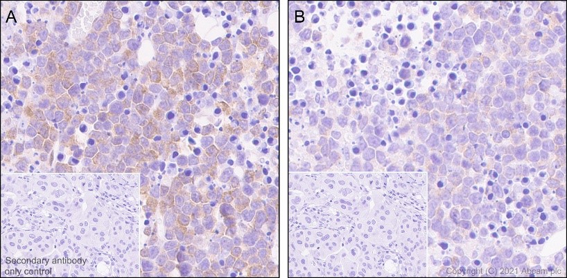 Immunohistochemistry (Formalin/PFA-fixed paraffin-embedded sections) - Anti-EIF2S1 (phospho S51) antibody [E90] (AB32157), expandable thumbnail