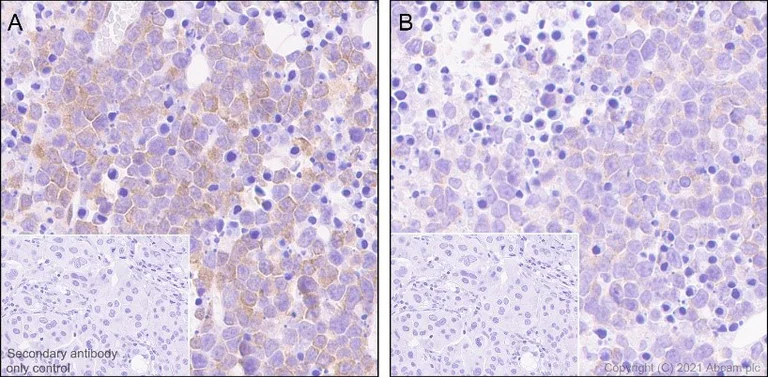 Immunohistochemistry (Formalin/PFA-fixed paraffin-embedded sections) - Anti-EIF2S1 (phospho S51) antibody [E90] (AB32157)