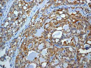 Immunohistochemistry (Formalin/PFA-fixed paraffin-embedded sections) - Anti-EIF2S1 (phospho S51) antibody [E90] (ab32157), expandable thumbnail