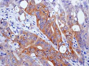 Immunohistochemistry (Formalin/PFA-fixed paraffin-embedded sections) - Anti-EIF2S1 (phospho S51) antibody [E90] (ab32157), expandable thumbnail