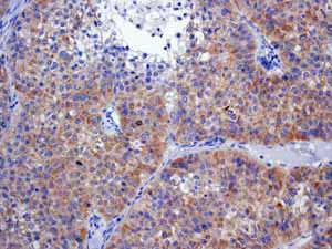 Immunohistochemistry (Formalin/PFA-fixed paraffin-embedded sections) - Anti-EIF2S1 (phospho S51) antibody [E90] (ab32157), expandable thumbnail