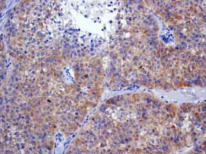 Immunohistochemistry (Formalin/PFA-fixed paraffin-embedded sections) - Anti-EIF2S1 (phospho S51) antibody [E90] (AB32157)