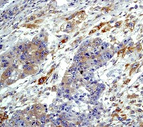 Immunohistochemistry (Formalin/PFA-fixed paraffin-embedded sections) - Anti-EIF2S1 (phospho S51) antibody [E90] (ab32157), expandable thumbnail