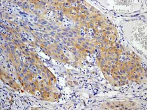 Immunohistochemistry (Formalin/PFA-fixed paraffin-embedded sections) - Anti-EIF2S1 (phospho S51) antibody [E90] (ab32157), expandable thumbnail