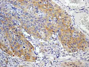 Immunohistochemistry (Formalin/PFA-fixed paraffin-embedded sections) - Anti-EIF2S1 (phospho S51) antibody [E90] (AB32157)