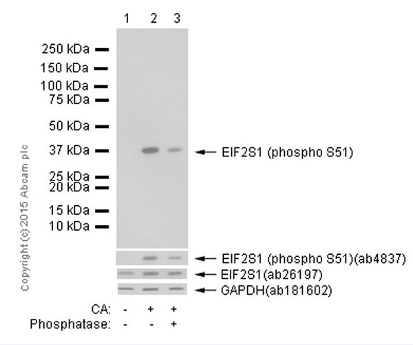 Western blot - Anti-EIF2S1 (phospho S51) antibody [E90] (AB32157), expandable thumbnail