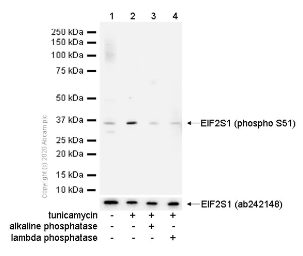 Western blot - Anti-EIF2S1 (phospho S51) antibody [E90] (AB32157)