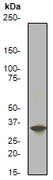 Western blot - Anti-EIF2S1 (phospho S51) antibody [E90] (ab32157), expandable thumbnail