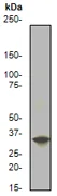 Western blot - Anti-EIF2S1 (phospho S51) antibody [E90] (AB32157)