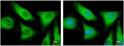 Immunocytochemistry/ Immunofluorescence - Anti-EIF2S2/EIF2B antibody (AB155649)