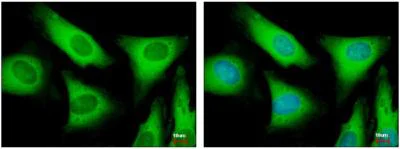 Immunocytochemistry/ Immunofluorescence - Anti-EIF2S2/EIF2B antibody (AB155649)