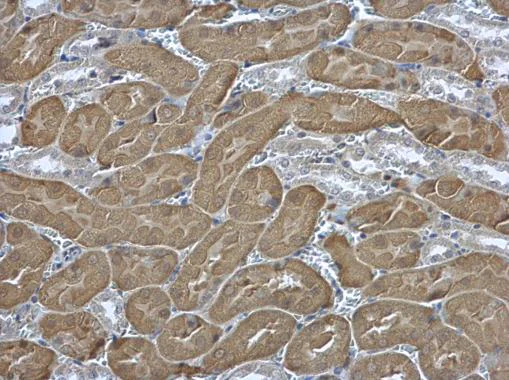 Immunohistochemistry (Formalin/PFA-fixed paraffin-embedded sections) - Anti-EIF2S2/EIF2B antibody (AB155649)
