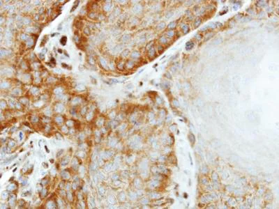 Immunohistochemistry (Formalin/PFA-fixed paraffin-embedded sections) - Anti-EIF2S2/EIF2B antibody (AB155649)