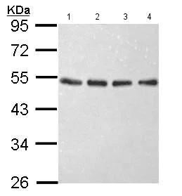 Western blot - Anti-EIF2S2/EIF2B antibody (AB155649)