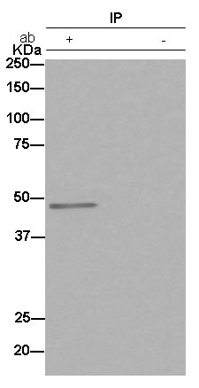 Immunoprecipitation - Anti-EIF2S2/EIF2B antibody [EPR15833(B)] - BSA and Azide free (AB250752), expandable thumbnail