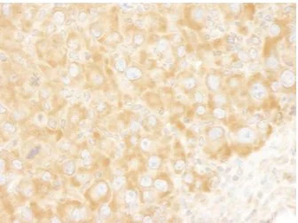 Immunohistochemistry (Formalin/PFA-fixed paraffin-embedded sections) - Anti-eIF3A antibody (AB105113)