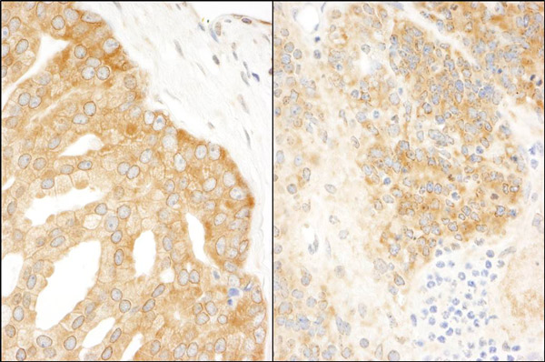 Immunohistochemistry (Formalin/PFA-fixed paraffin-embedded sections) - Anti-eIF3A antibody (AB86146)