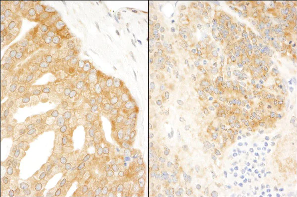 Immunohistochemistry (Formalin/PFA-fixed paraffin-embedded sections) - Anti-eIF3A antibody (AB86146)