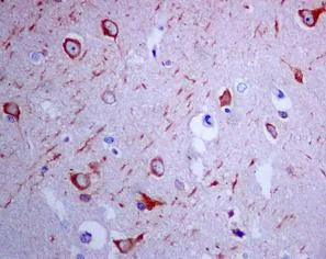 Immunohistochemistry (Formalin/PFA-fixed paraffin-embedded sections) - Anti-eIF3A antibody [EPR5819(2)] - BSA and Azide free (AB248250)
