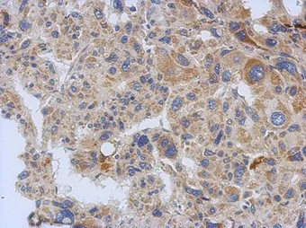 Immunohistochemistry (Formalin/PFA-fixed paraffin-embedded sections) - Anti-eIF3A antibody - N-terminal (AB155412)