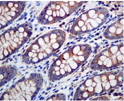 Immunohistochemistry (Formalin/PFA-fixed paraffin-embedded sections) - Anti-eIF3B antibody [EPR5805] - BSA and Azide free (AB248000)