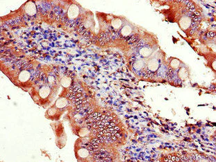 Immunohistochemistry (Formalin/PFA-fixed paraffin-embedded sections) - Anti-EIF3C antibody (AB237757)