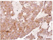 Immunohistochemistry (Formalin/PFA-fixed paraffin-embedded sections) - Anti-EIF3D antibody (AB155419)