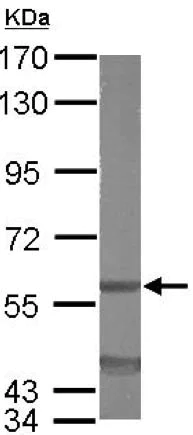 Western blot - Anti-EIF3D antibody (AB155419)