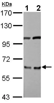 Western blot - Anti-EIF3D antibody (AB155419)