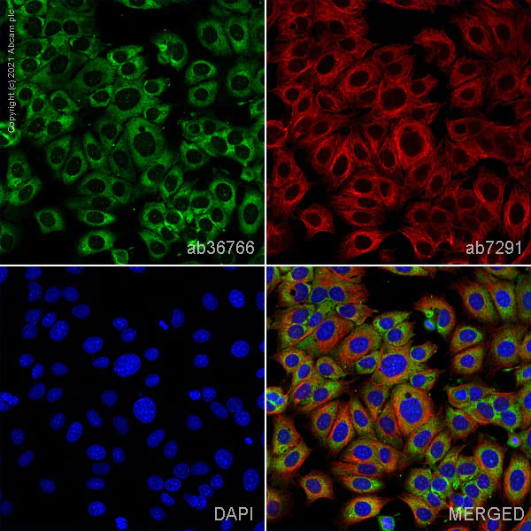 Immunocytochemistry/ Immunofluorescence - Anti-eIF3e antibody (AB36766)
