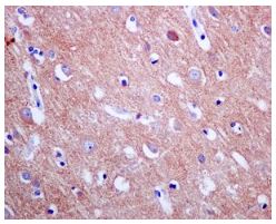 Immunohistochemistry (Formalin/PFA-fixed paraffin-embedded sections) - Anti-eIF3e antibody [EPR6878(2)] - BSA and Azide free (AB248752), expandable thumbnail