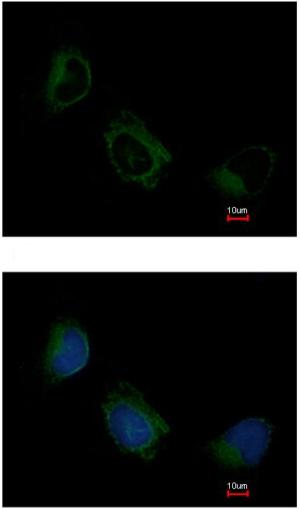 Immunocytochemistry/ Immunofluorescence - Anti-EIF3F antibody (AB155475), expandable thumbnail