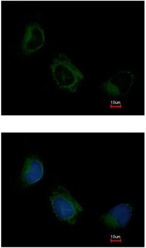 Immunocytochemistry/ Immunofluorescence - Anti-EIF3F antibody (AB155475)