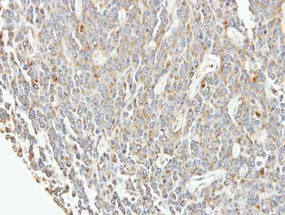 Immunohistochemistry (Formalin/PFA-fixed paraffin-embedded sections) - Anti-EIF3F antibody (AB155475)
