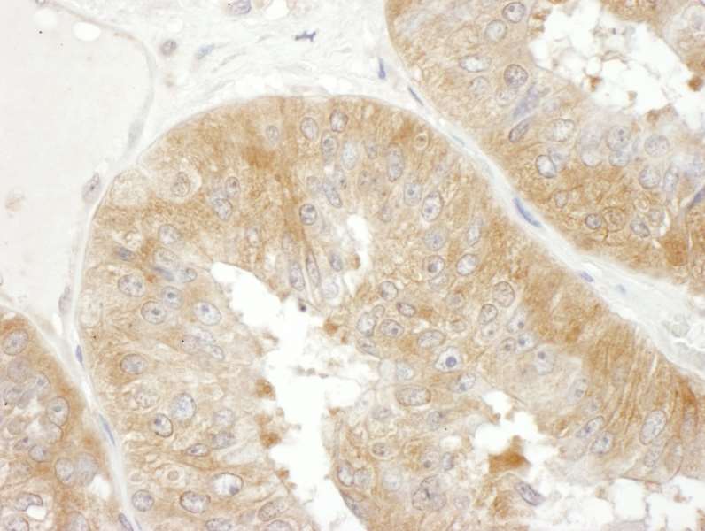 Immunohistochemistry (Formalin/PFA-fixed paraffin-embedded sections) - Anti-EIF3F antibody (AB176853)