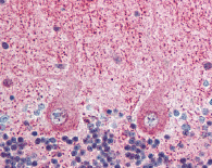 Immunohistochemistry (Formalin/PFA-fixed paraffin-embedded sections) - Anti-EIF3F antibody (AB64177)