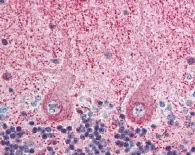 Immunohistochemistry (Formalin/PFA-fixed paraffin-embedded sections) - Anti-EIF3F antibody (AB64177)