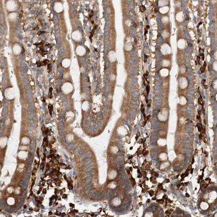 Immunohistochemistry (Formalin/PFA-fixed paraffin-embedded sections) - Anti-EIF3H antibody (AB251743)