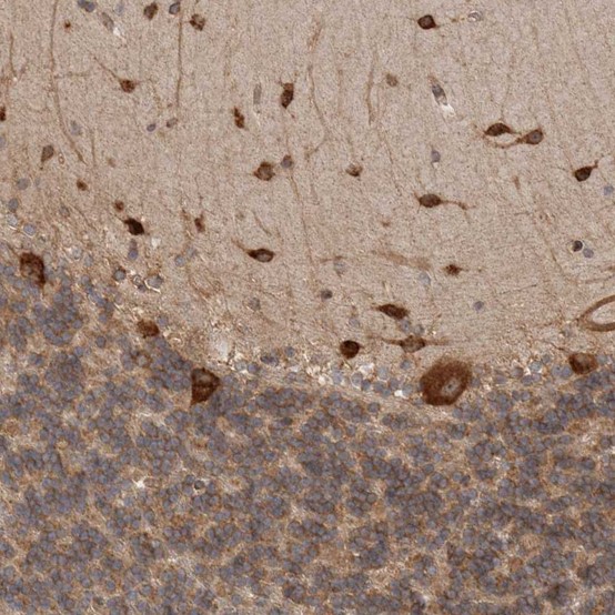 Immunohistochemistry (Formalin/PFA-fixed paraffin-embedded sections) - Anti-EIF3H antibody (AB251743)